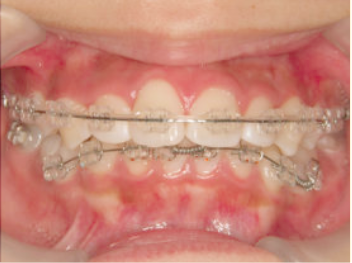 case-card-img-1