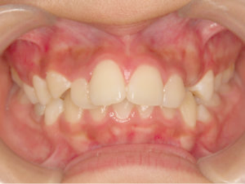 case-card-img-2